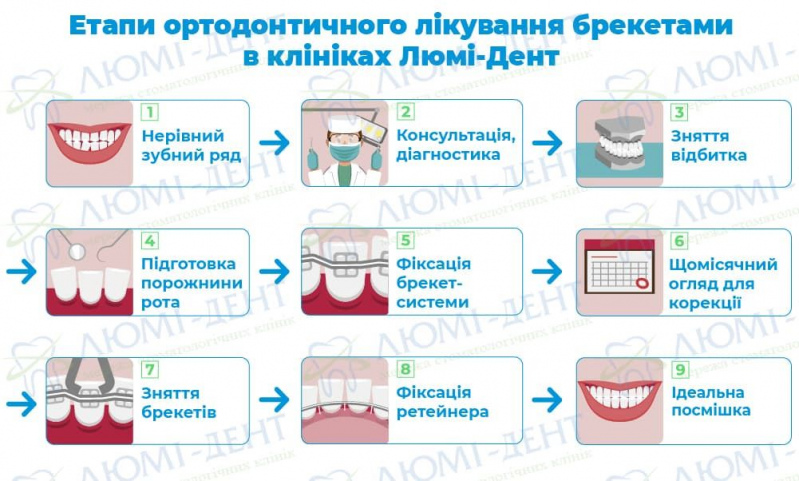 Брекети на зуби фото Люмі-Дент